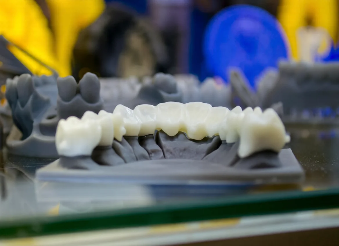 Lingual Collar Zirconia Crowns & Bridges