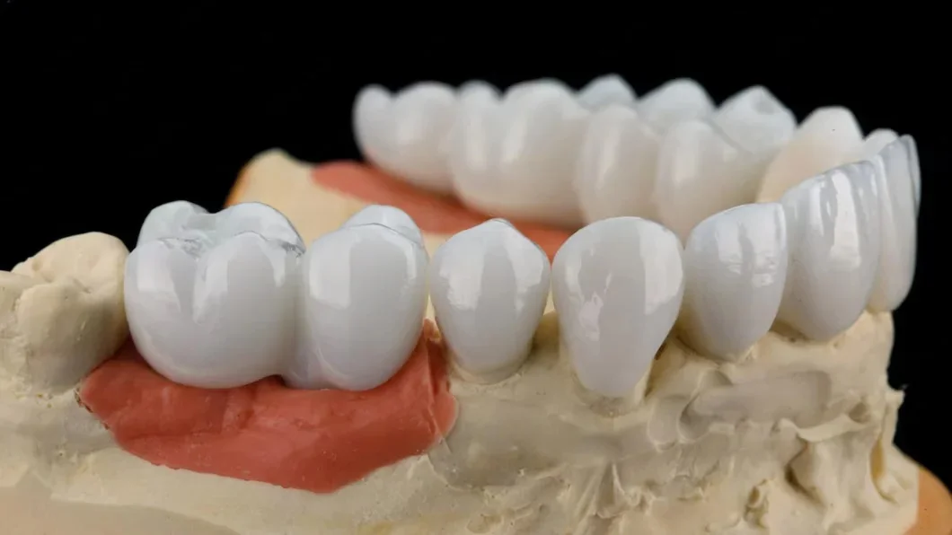 Monolithic Zirconia Crowns and Bridges