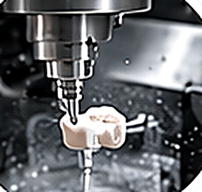 Manufacturing step