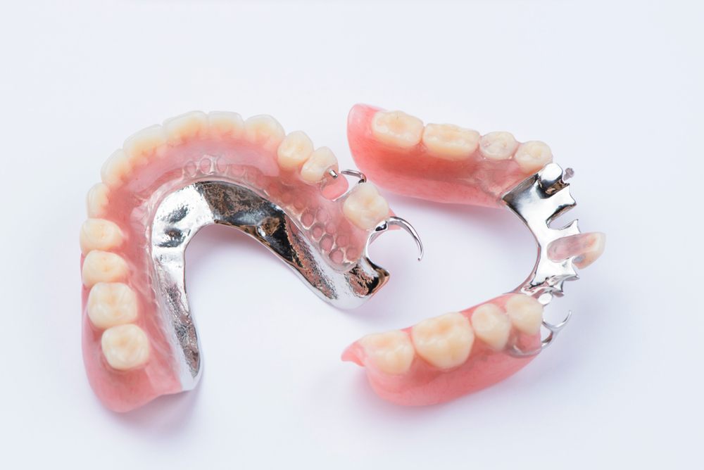 Removable Partial Denture