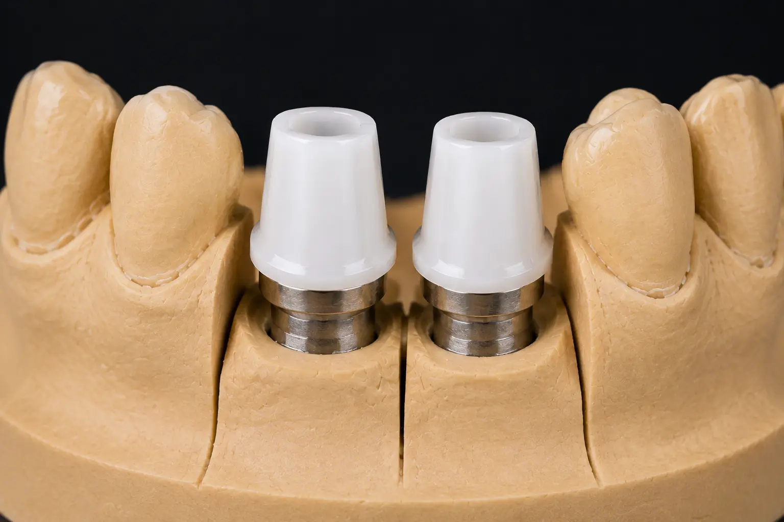 Zirconia Coping